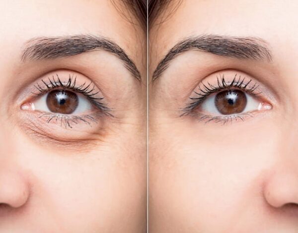 Spot for the online intensive class: GET RID OF DARK CIRCLES, EYE BAGS, HOLLOW EYES & EYE WRINKLES. Start 14.04.25 Workbook for free.